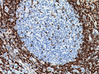Tonsil stained with Bcl-2 antibody