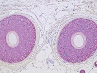 Skin stained with Pan Cytokeratin antibody