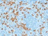 Tonsil stained with Lambda Light Chain antibody