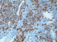 Tonsil stained with LCA antibody cocktail