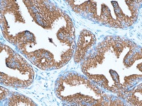Prostate stained with PSA antibody cocktail