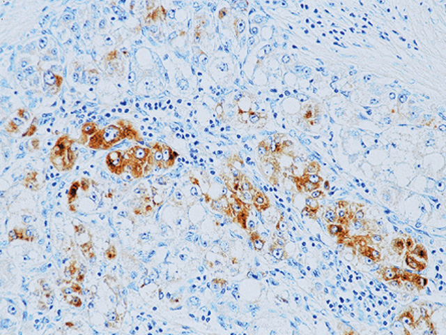 Alpha-1-Fetoprotein (AFP)