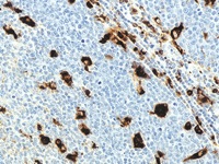 Tonsil stained with CD68 antibody