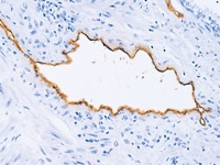 Lung artery stained with Factor VIII antibody