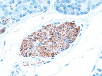 Nerve tissue stained with NSE antibody