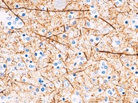 Brain tissue stained with neurofilament antibody