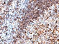 Tonsil stained with CD79a antibody