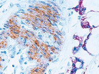 Artery stained with MSA antibody