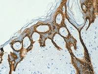 Skin stained withg LMW Cytokeratin antibody