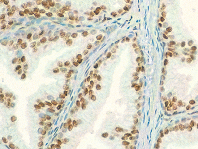 Androgen Receptor