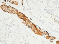 Skin stained with Collagen IV antibody