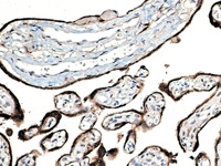 Placenta stained with hCG antibody