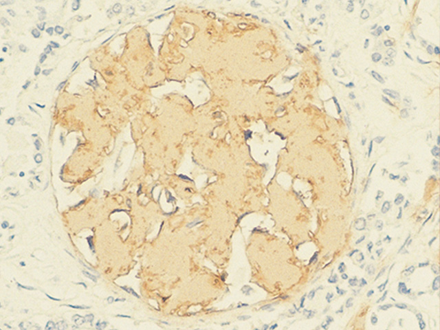 Amyloid A