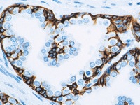 Prostate stained with HMW Cytokeratin antibody