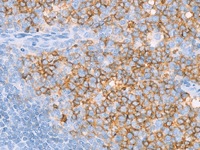 Tonsil stained with CD10 antibody