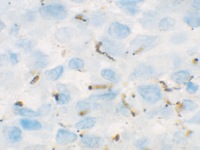 Spirochete infected tissue stained with Treponema pallidum antibody
