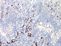Colon tissue stained with BrdU antibody