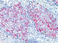 Tonsil stained with CD22 antibody