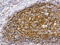Tonsil stained with CD21 antibody
