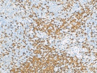 Tonsil stained with CD4 antibody