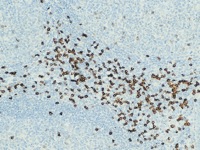 Tonsil stained with CD8 antibody