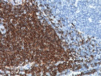 Tonsil stained with CD7 antibody