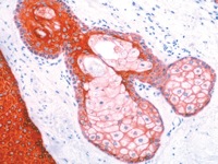 Skin stained with Pan Cytokeratin antibody cocktail