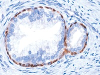 Prostate stained with p63 antibody