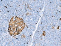 Pancreas stained with CD56 antibody