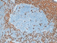 Tonsil stained with CD138 antibody