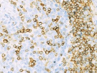 Tonsil stained with CD22 antibody