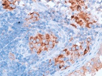 Testicular tissue stained with Inhibin alpha antibody