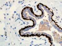 Mouse cerebellum stained with Calbindin antibody