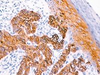 Skin stained with CK19 antibody