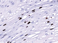 Cervix stained with HPV antibody cocktail