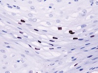 Cervix stained with HPV-16 antibody.