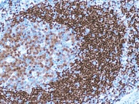 Tonsil  stained with PAX-5 antibody