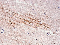 Brain tissue stained with Clusterin antibody