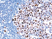 Tonsil stained with MLH-1 antibody