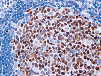 Tonsil stained with Bcl-6 antibody