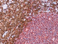 Tonsil stained with L26 + CD3.
