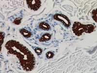 Skin stained with Cytokeratin 19 antibody
