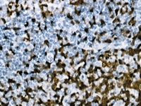Tonsil stained with ZAP-70 antibody.
