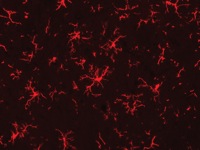Rat spinal cord stained with Microglia antibody
