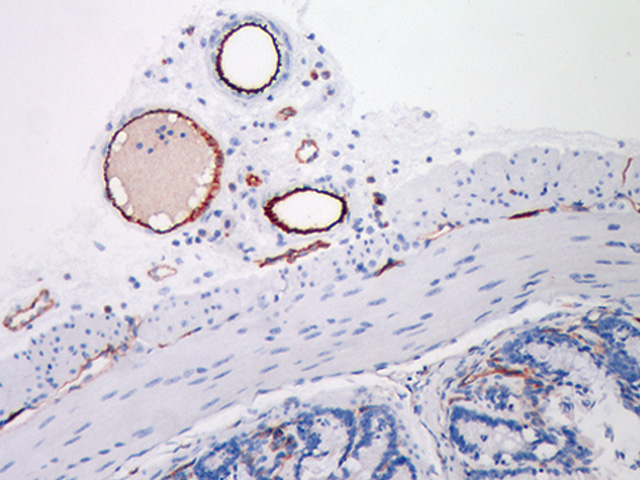 mouse colon stained with cd31