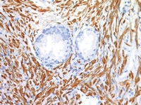 Prostate stained with SMA antibody