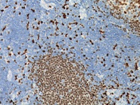 Normal tonsil stained with PU.1 antibody