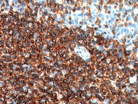 Tonsil stained with CD19 antibody