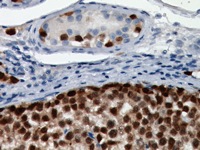 Seminoma stained with Oct-3/4 antibody