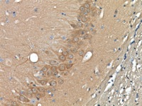 Brain tissue stained with PGP9.5 antibody